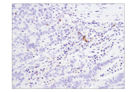 Immunohistochemistry Image 2: 4-1BB/CD137/TNFRSF9 (D2Z4Y) Rabbit mAb (BSA and Azide Free)