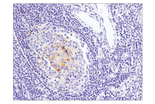 Immunohistochemistry Image 3: 4-1BB/CD137/TNFRSF9 (D2Z4Y) Rabbit mAb (BSA and Azide Free)