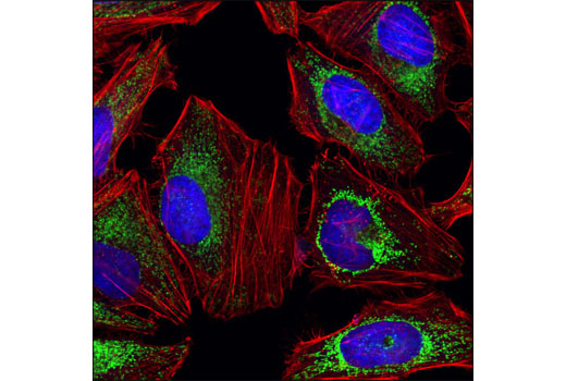 Immunofluorescence Image 1: SDHA Antibody