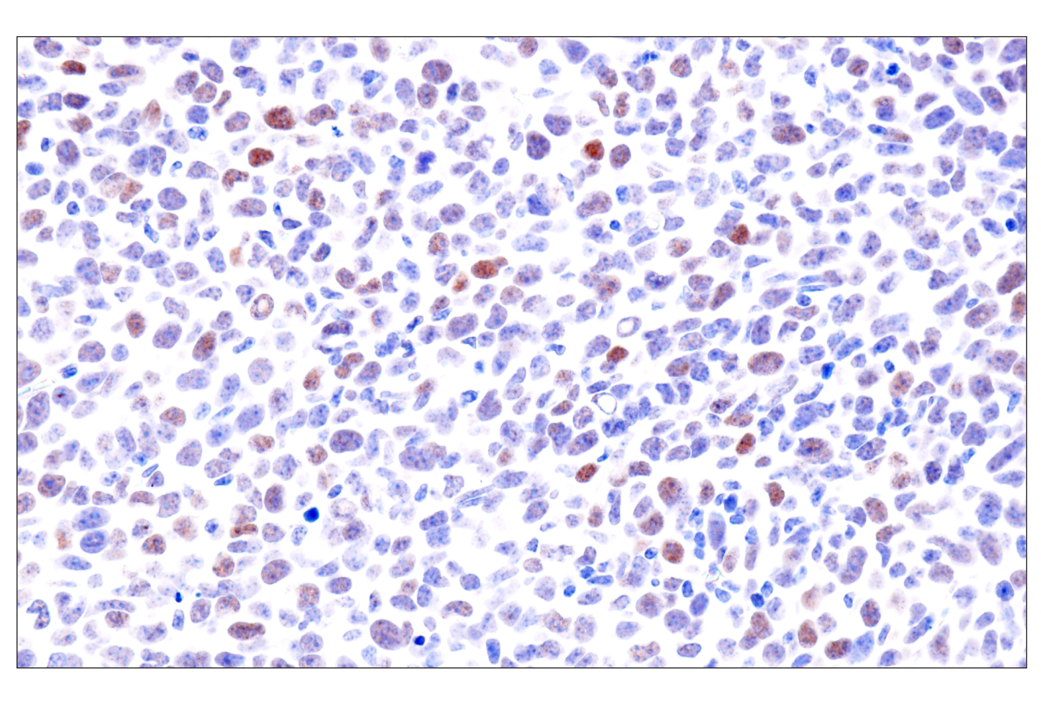 Immunohistochemistry Image 16: GATA-6 (D61E4) XP® Rabbit mAb