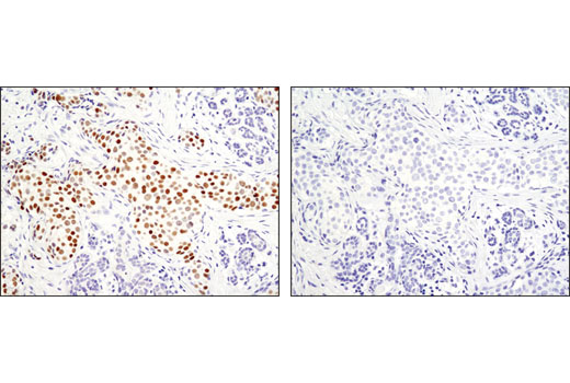 Immunohistochemistry Image 1: GATA-3 (D13C9) XP® Rabbit mAb