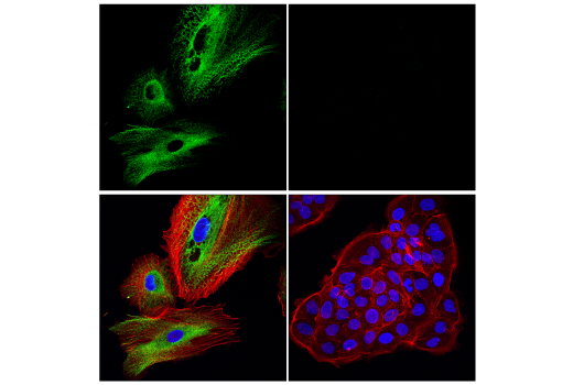 Immunofluorescence Image 4: MAP1B Antibody