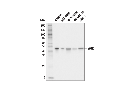 Western Blotting Image 1: AGK Antibody