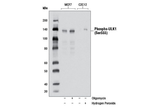  Image 1: PhosphoPlus® ULK1 (Ser555) Antibody Duet