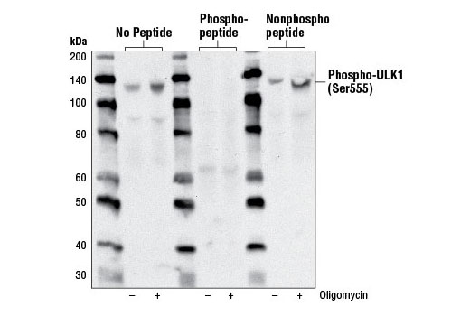  Image 7: PhosphoPlus® ULK1 (Ser555) Antibody Duet