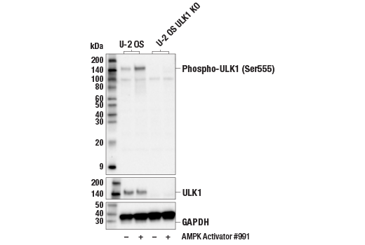  Image 3: PhosphoPlus® ULK1 (Ser555) Antibody Duet