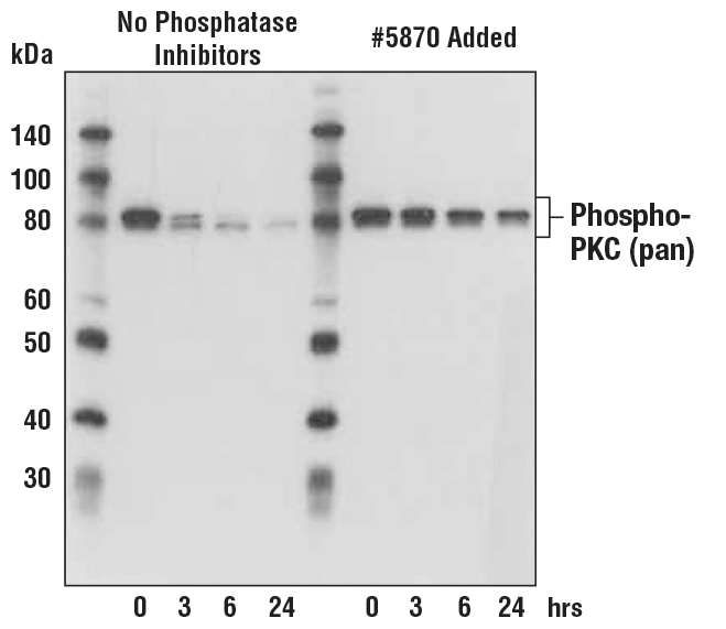 Western Blotting Image 1: Phosphatase Inhibitor Cocktail (100X)