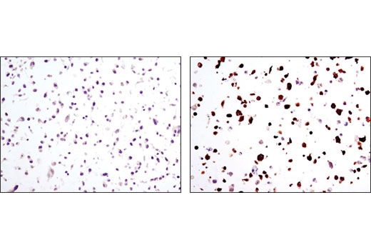 Immunohistochemistry Image 1: Myc-Tag (9B11) Mouse mAb (BSA and Azide Free)