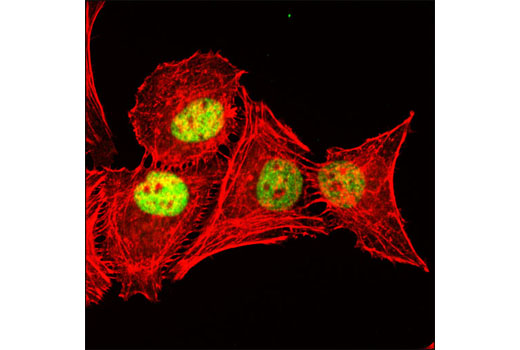 Immunofluorescence Image 1: STAG2 (D25A4) XP® Rabbit mAb