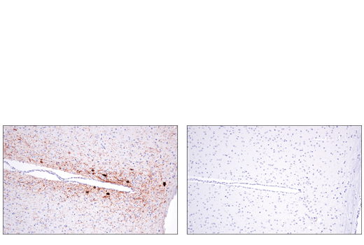  Image 17: Functional Neuron Marker Antibody Sampler Kit