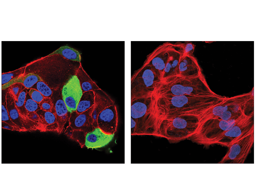 Immunofluorescence Image 2: Tyrosine Hydroxylase (E2L6M) Rabbit mAb