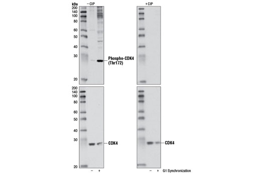Western Blotting Image 1: Phospho-CDK4 (Thr172) Antibody