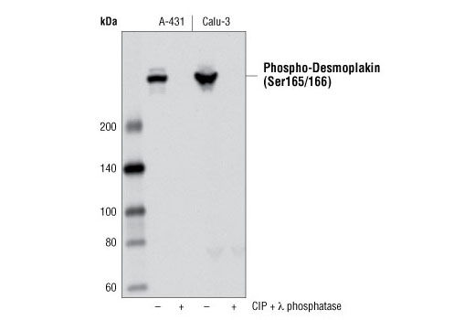 Western Blotting Image 1: Phospho-Desmoplakin (Ser165/166) Antibody