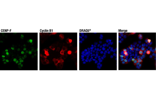 Immunofluorescence Image 2: CENP-F (D6X4L) Rabbit mAb