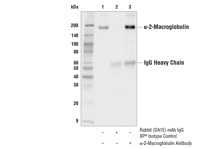 Immunoprecipitation Image 1: α-2-Macroglobulin Antibody