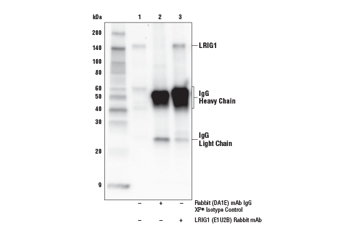 Immunoprecipitation Image 1: LRIG1 (E1U2B) Rabbit mAb