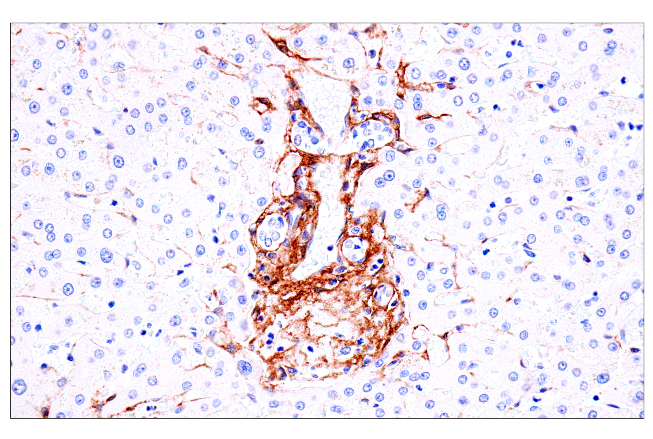 Immunohistochemistry Image 12: p75NTR (E7I3M) Rabbit mAb (BSA and Azide Free)