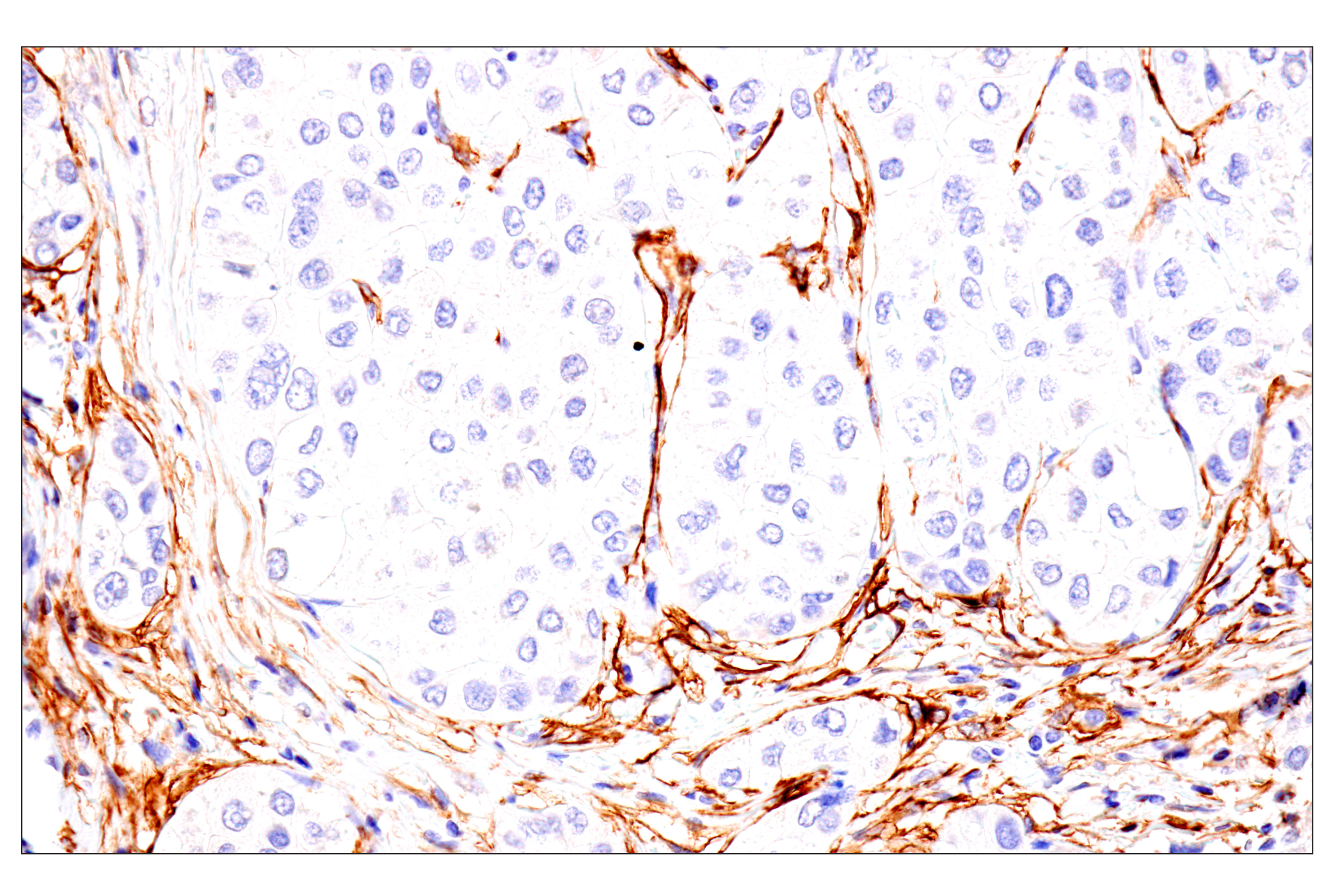 Immunohistochemistry Image 3: p75NTR (E7I3M) Rabbit mAb (BSA and Azide Free)