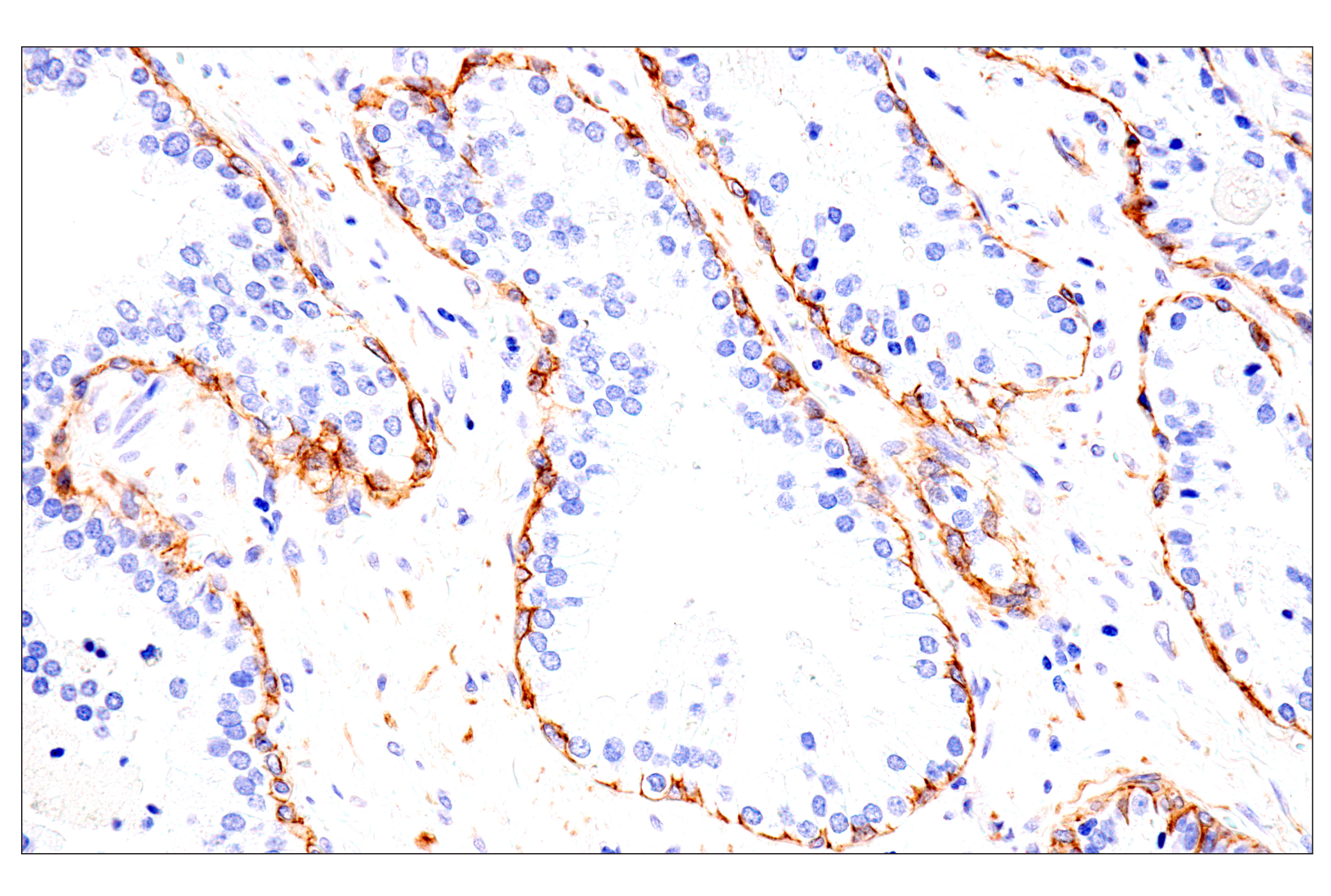 Immunohistochemistry Image 2: p75NTR (E7I3M) Rabbit mAb (BSA and Azide Free)