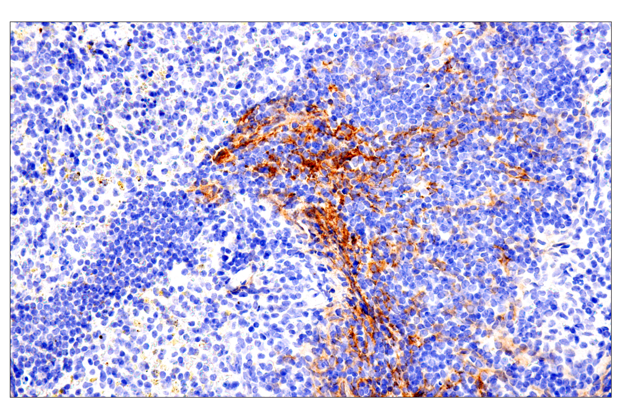 Immunohistochemistry Image 16: p75NTR (E7I3M) Rabbit mAb (BSA and Azide Free)