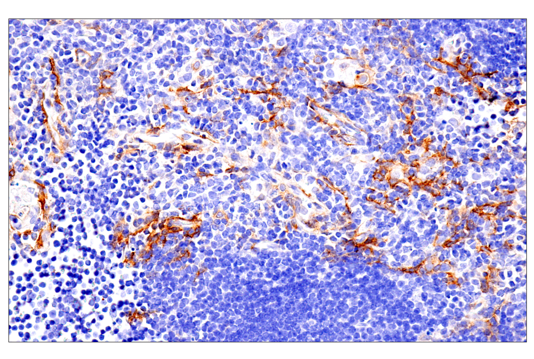 Immunohistochemistry Image 17: p75NTR (E7I3M) Rabbit mAb (BSA and Azide Free)