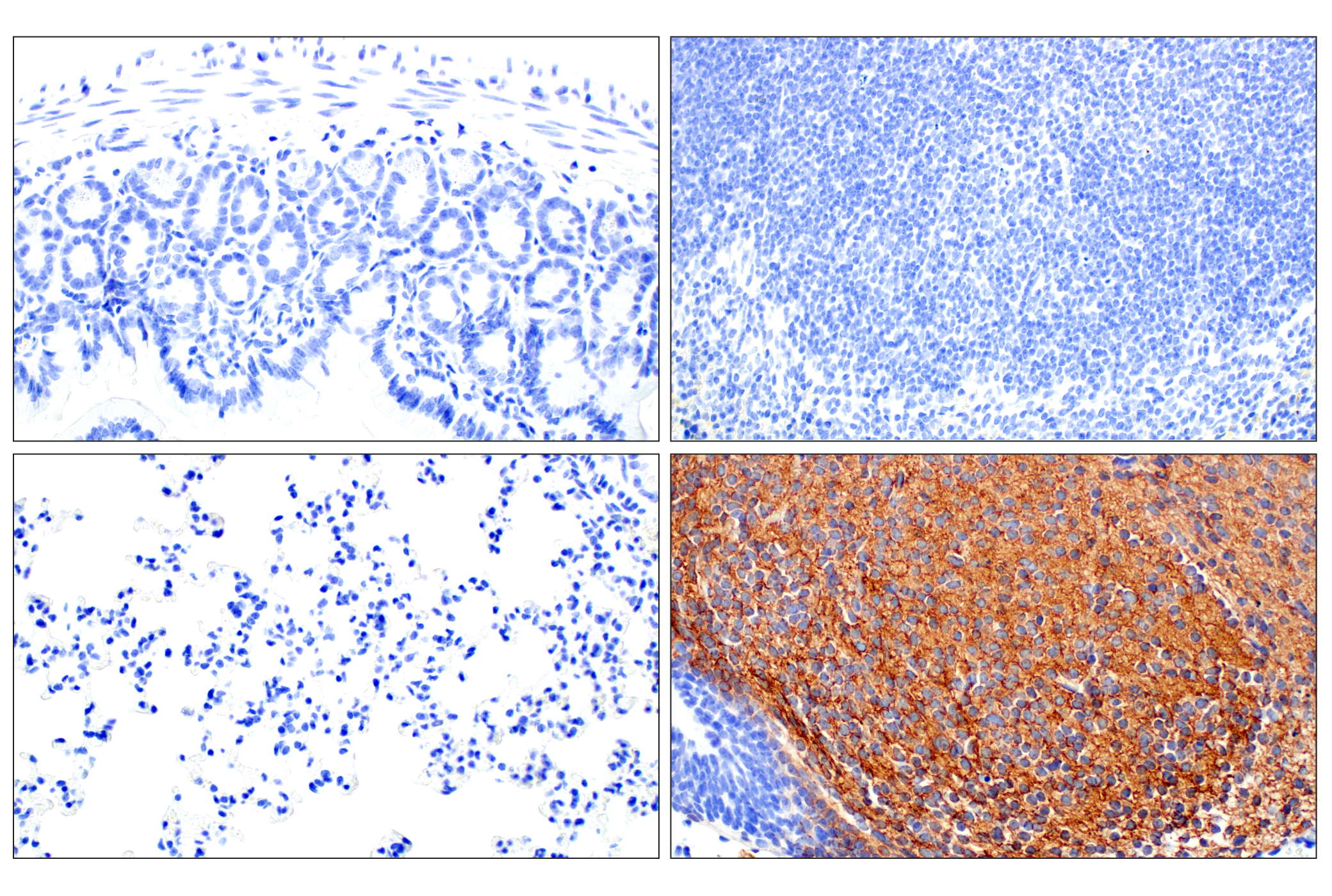 Immunohistochemistry Image 4: Doublecortin (E3S7L) Rabbit mAb (BSA and Azide Free)