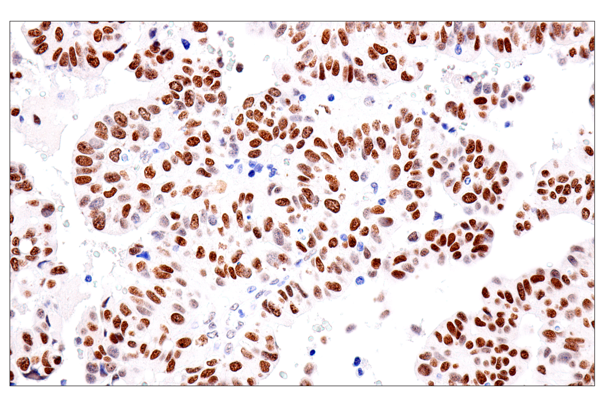 Immunohistochemistry Image 11: FoxA1/HNF3α (IHC578) Mouse mAb