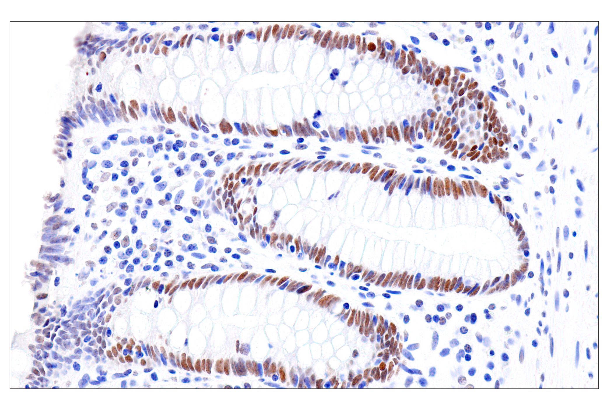 Immunohistochemistry Image 14: FoxA1/HNF3α (IHC578) Mouse mAb