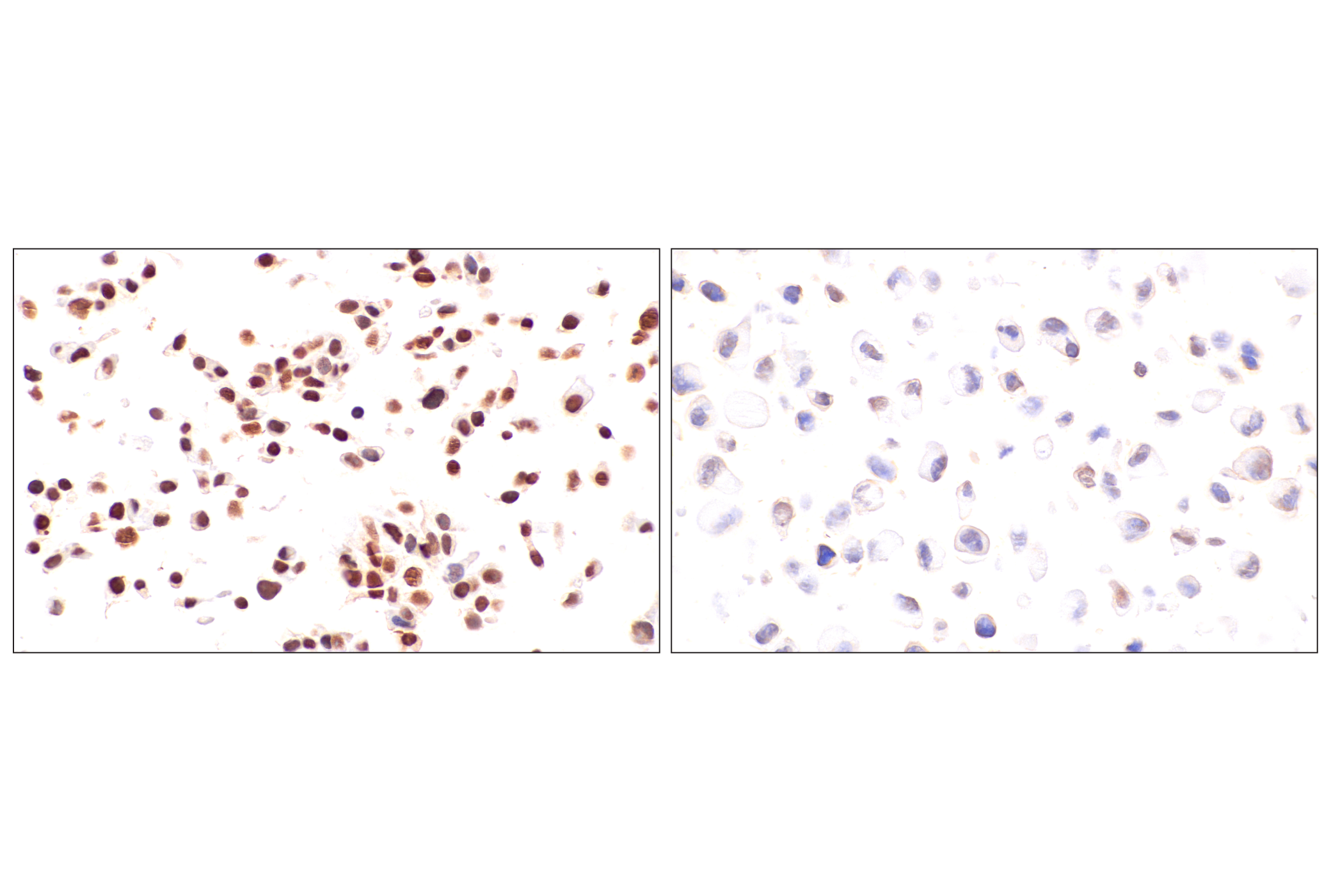 Immunohistochemistry Image 19: FoxA1/HNF3α (IHC578) Mouse mAb
