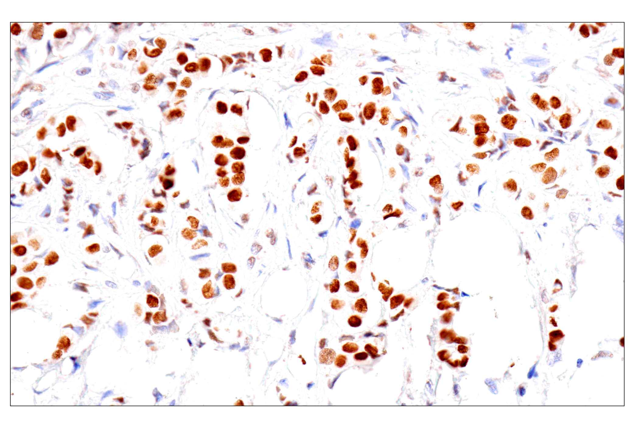 Immunohistochemistry Image 9: FoxA1/HNF3α (IHC578) Mouse mAb