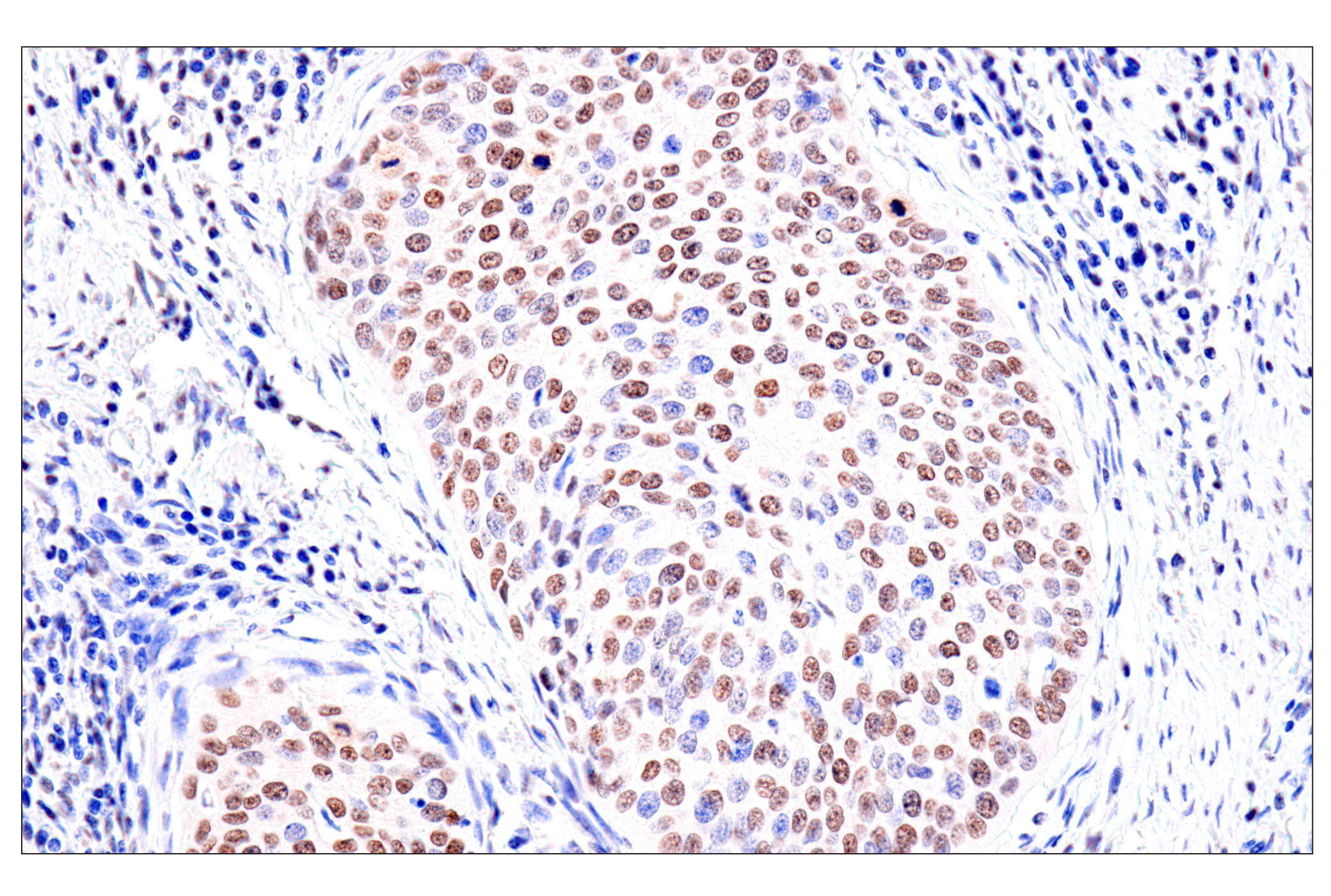 Immunohistochemistry Image 2: FoxA1/HNF3α (IHC578) Mouse mAb