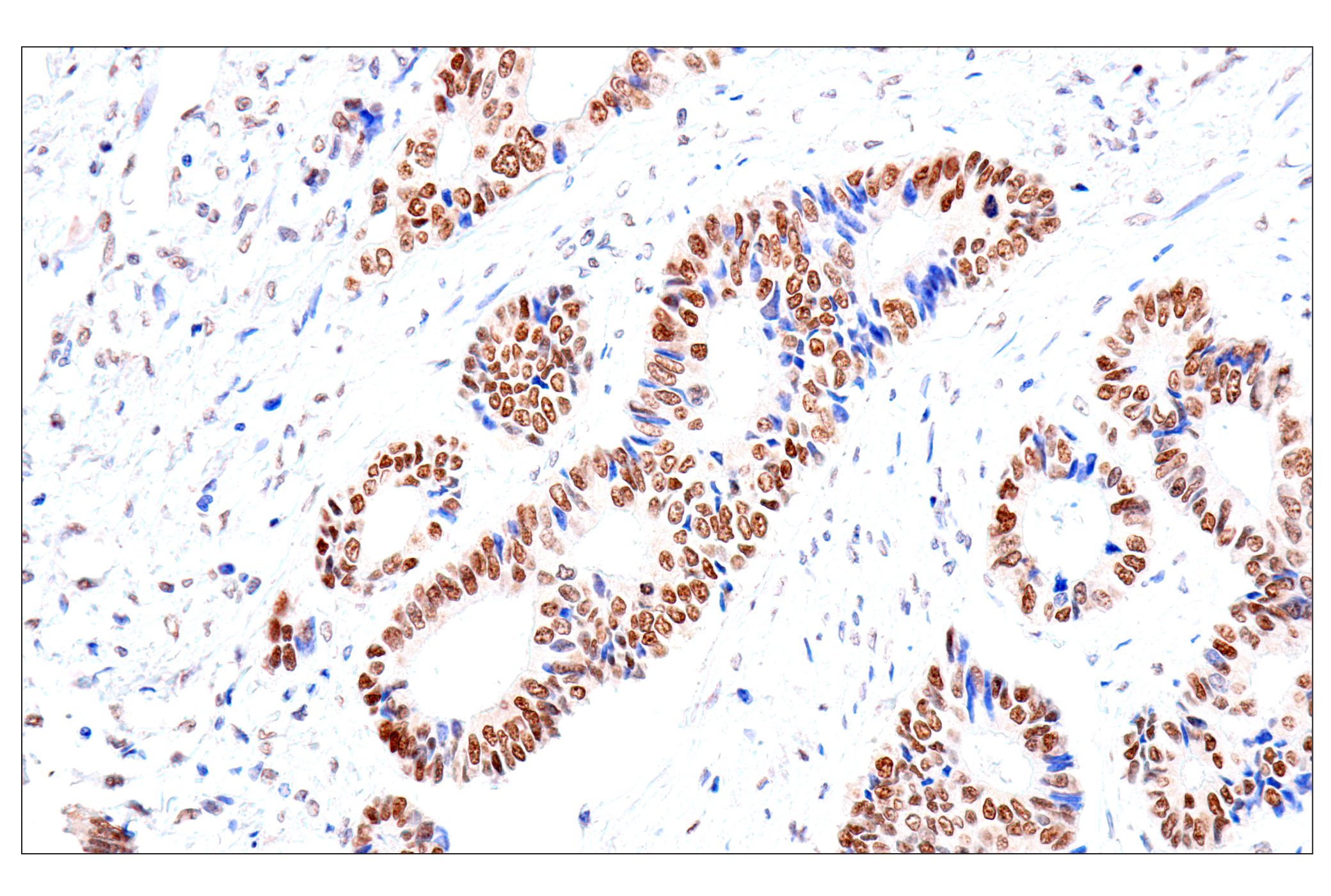Immunohistochemistry Image 1: FoxA1/HNF3α (IHC578) Mouse mAb