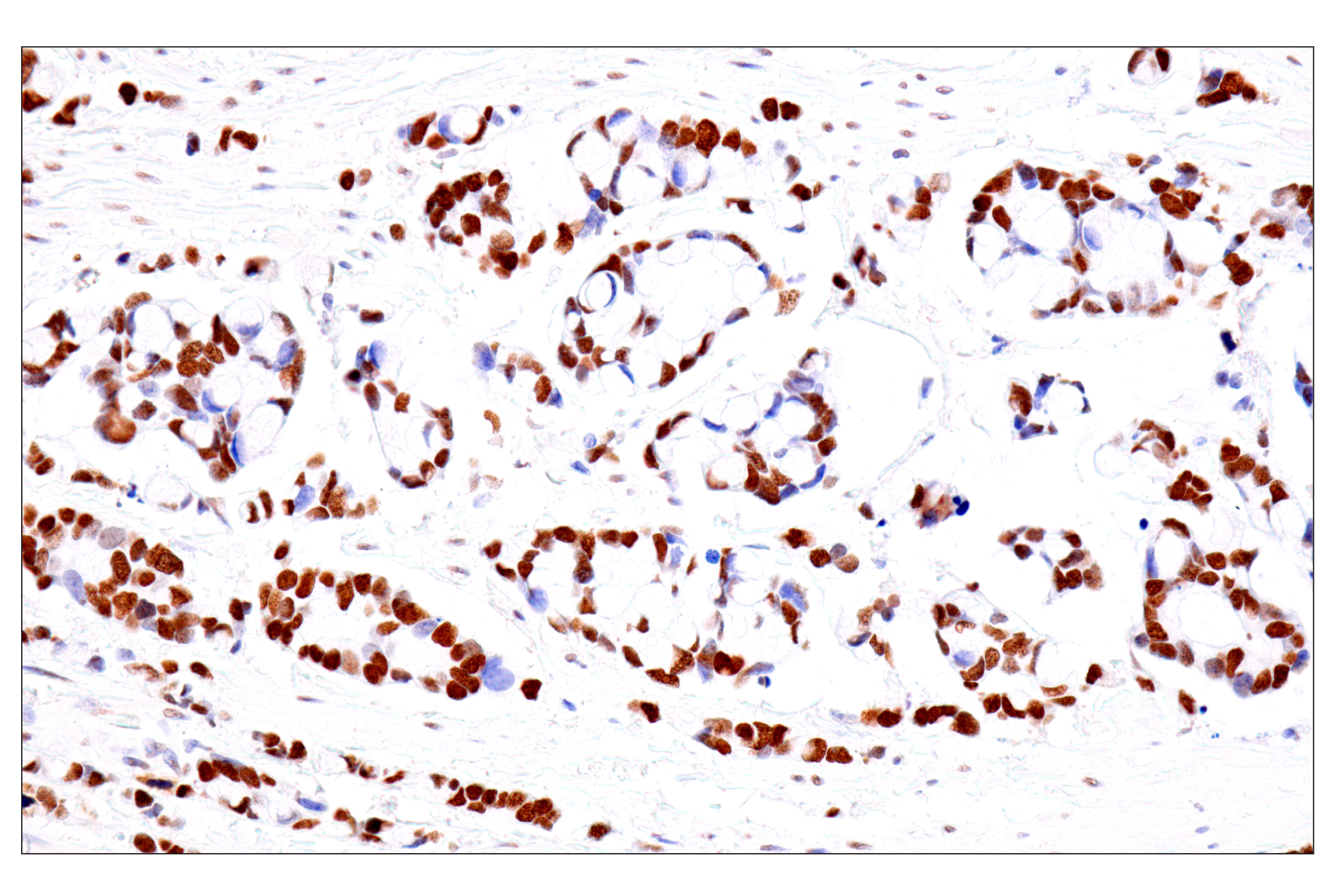Immunohistochemistry Image 10: FoxA1/HNF3α (IHC578) Mouse mAb