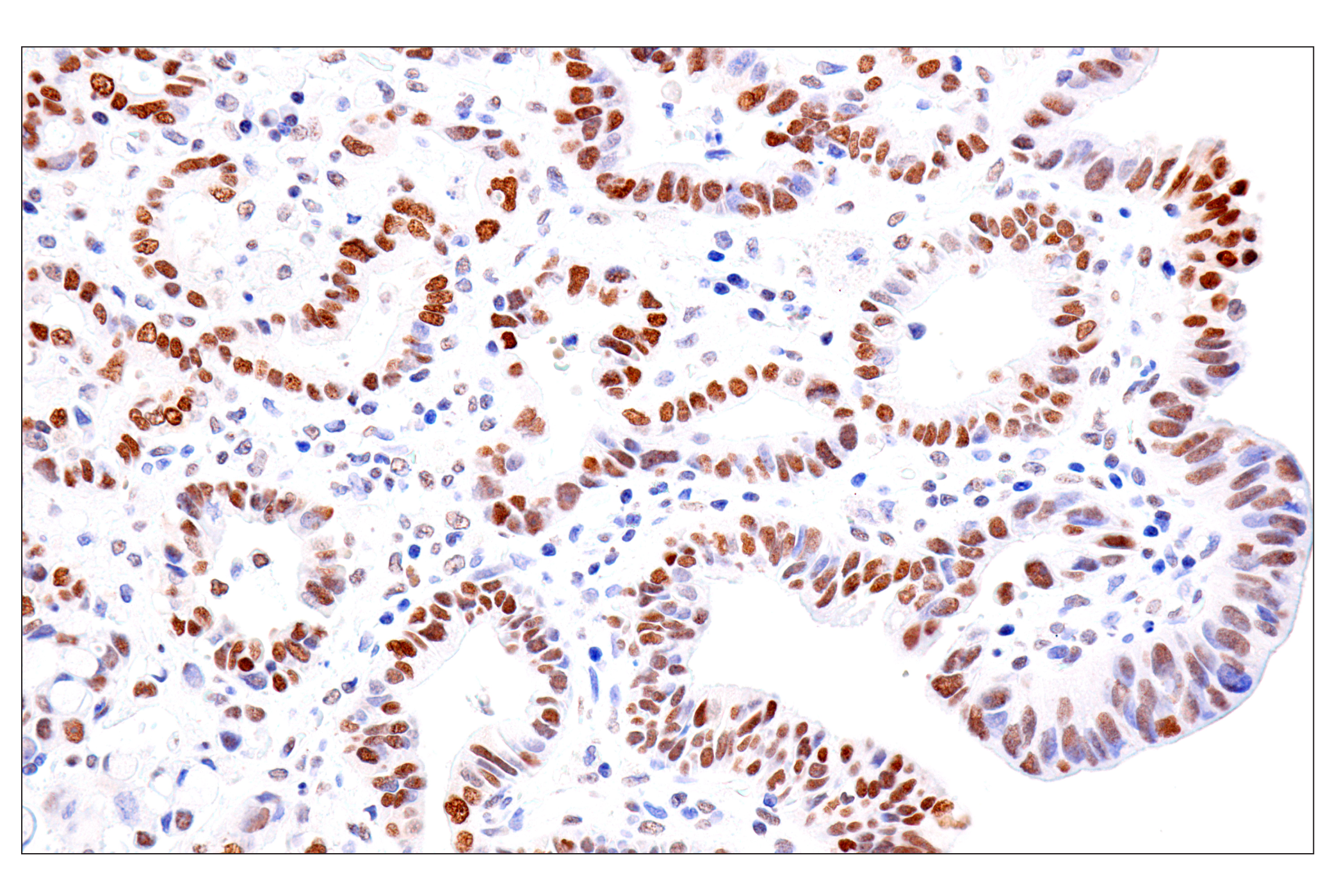 Immunohistochemistry Image 8: FoxA1/HNF3α (IHC578) Mouse mAb