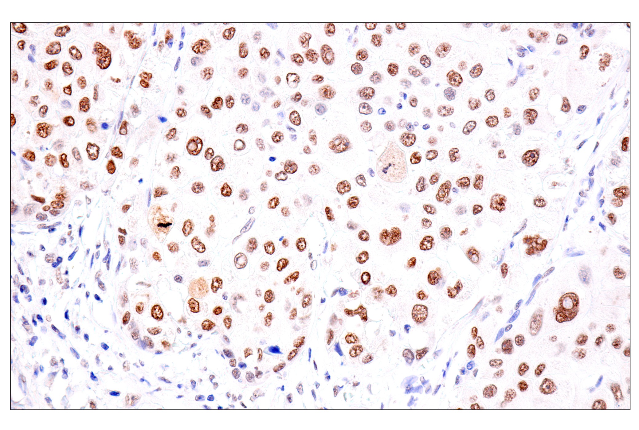 Immunohistochemistry Image 7: FoxA1/HNF3α (IHC578) Mouse mAb