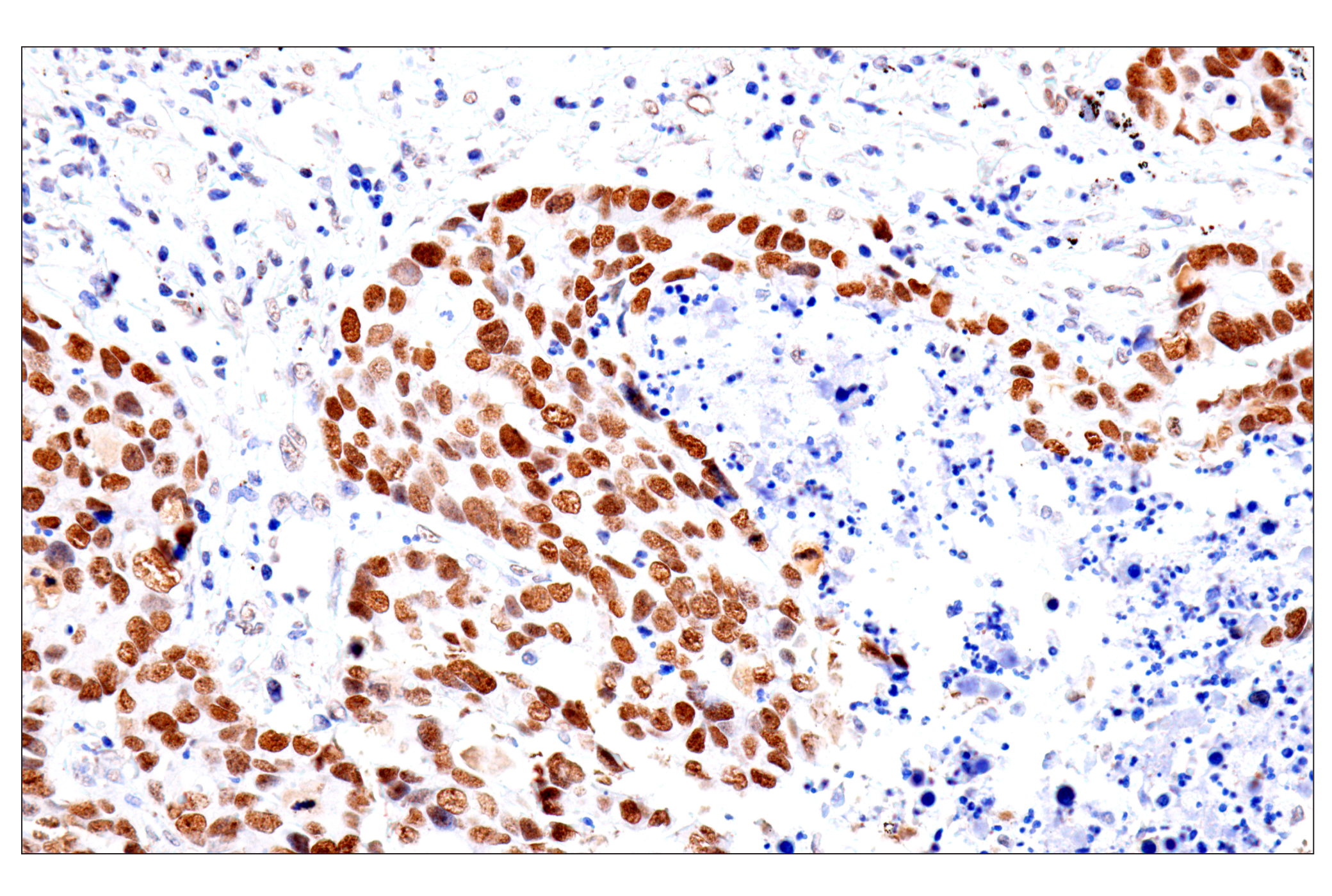 Immunohistochemistry Image 6: FoxA1/HNF3α (IHC578) Mouse mAb