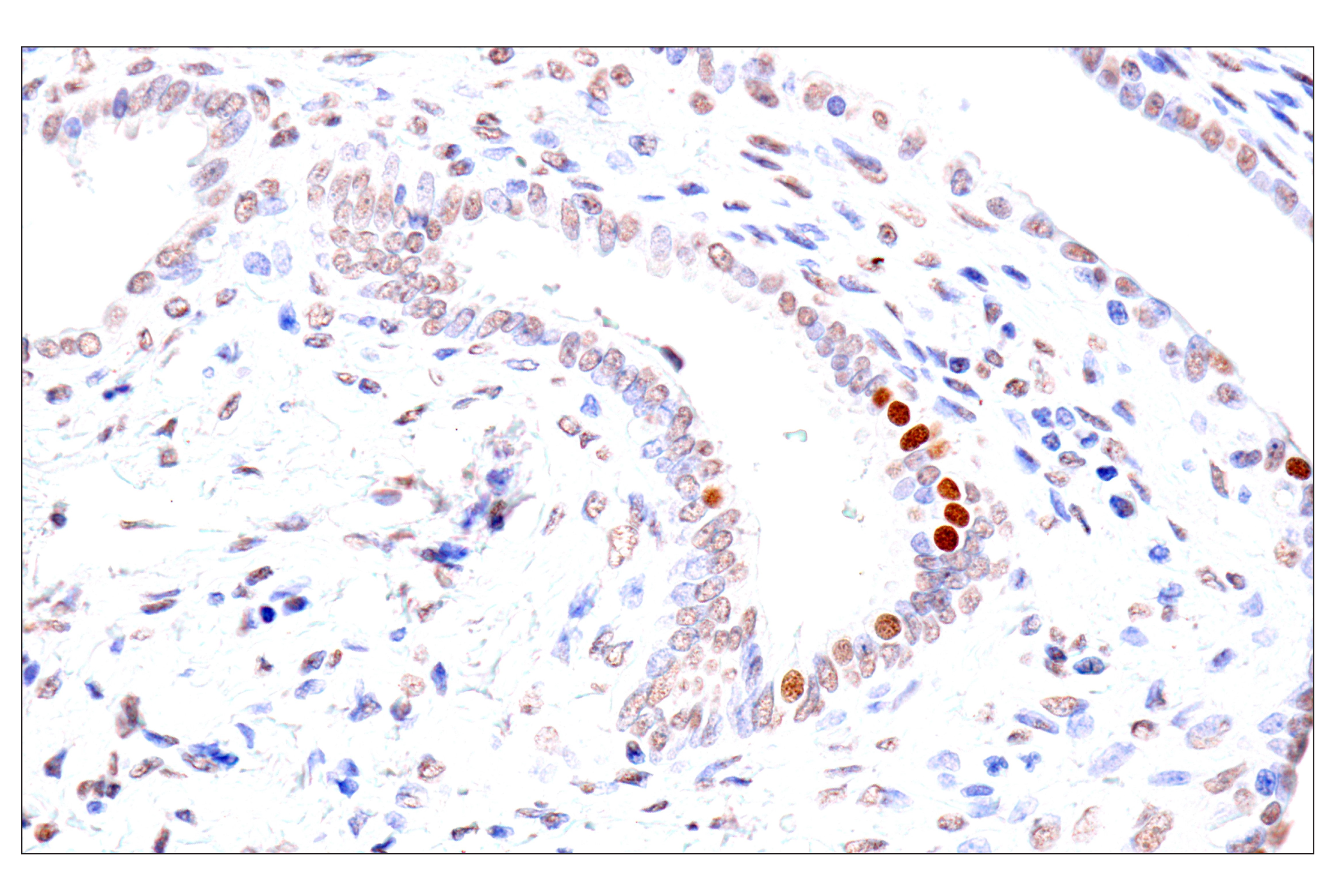Immunohistochemistry Image 5: FoxA1/HNF3α (IHC578) Mouse mAb