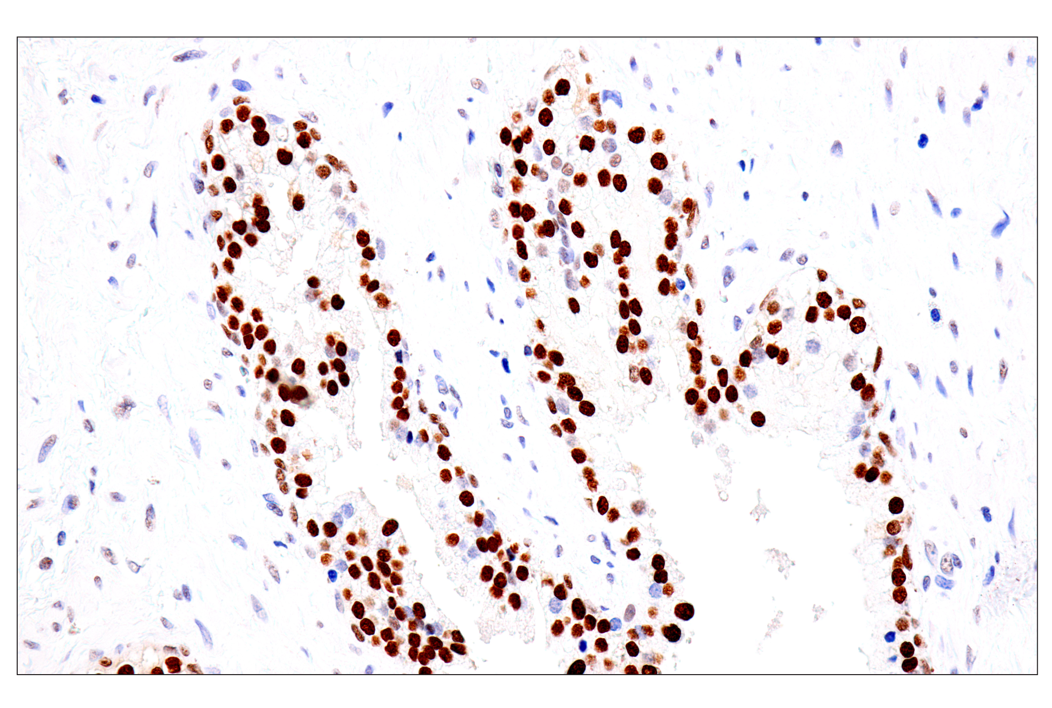 Immunohistochemistry Image 4: FoxA1/HNF3α (IHC578) Mouse mAb