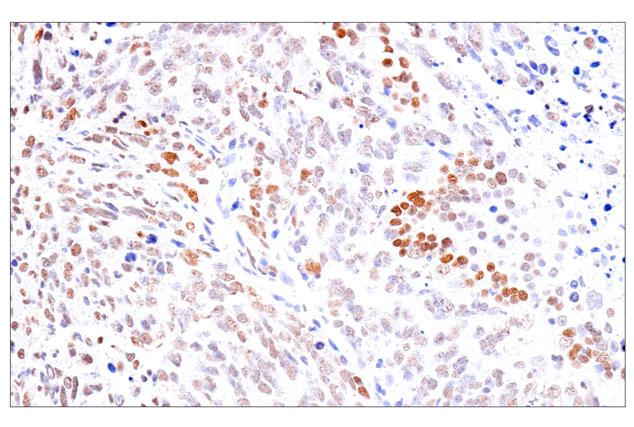 Immunohistochemistry Image 12: FoxA1/HNF3α (IHC578) Mouse mAb