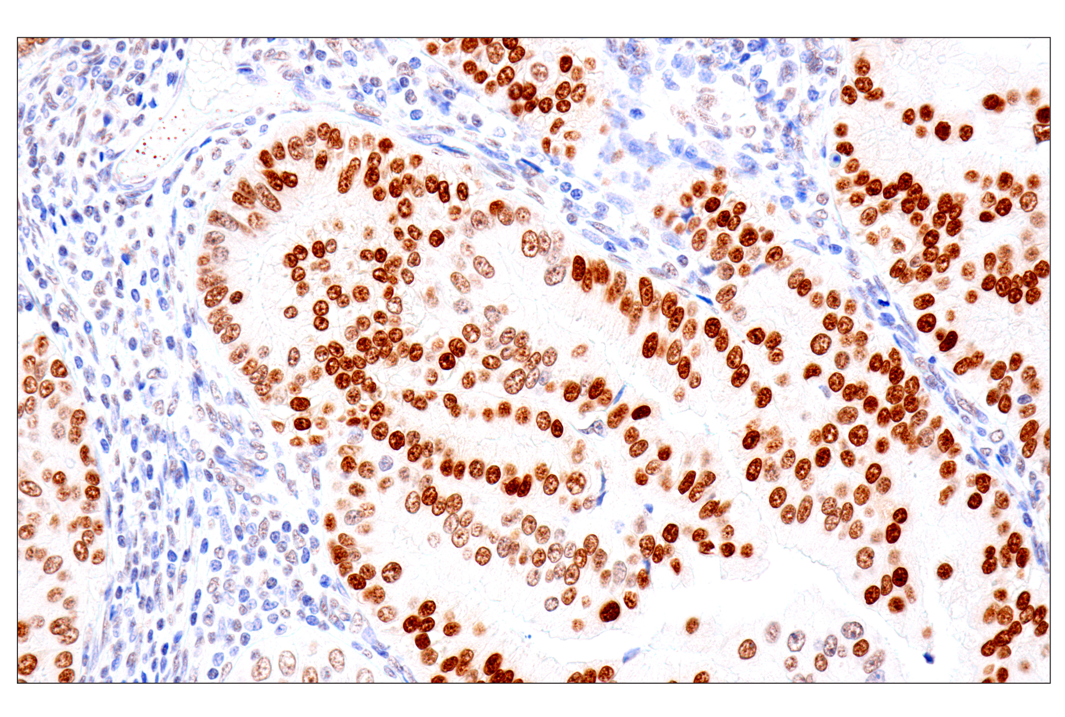 Immunohistochemistry Image 3: FoxA1/HNF3α (IHC578) Mouse mAb