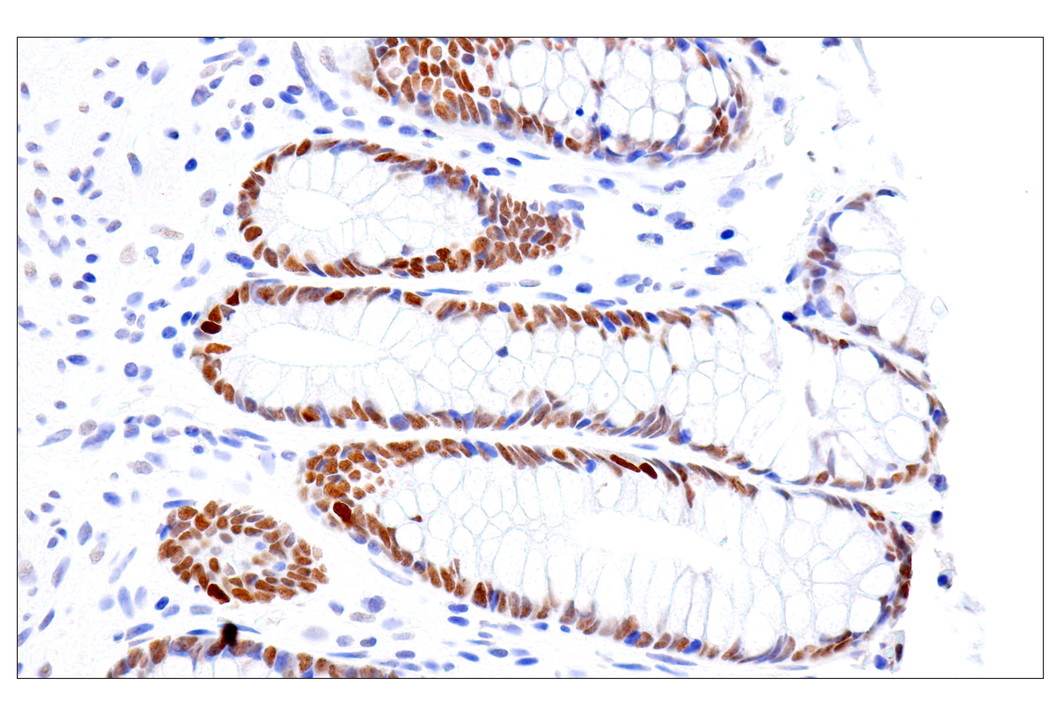 Immunohistochemistry Image 13: FoxA1/HNF3α (IHC578) Mouse mAb