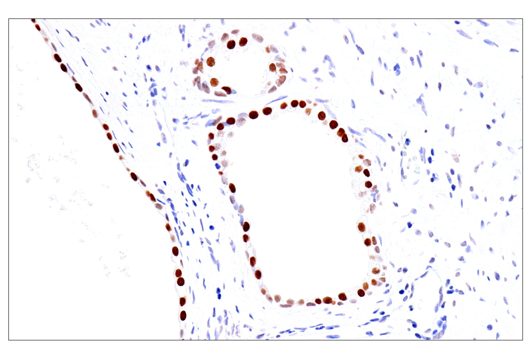 Immunohistochemistry Image 17: FoxA1/HNF3α (IHC578) Mouse mAb