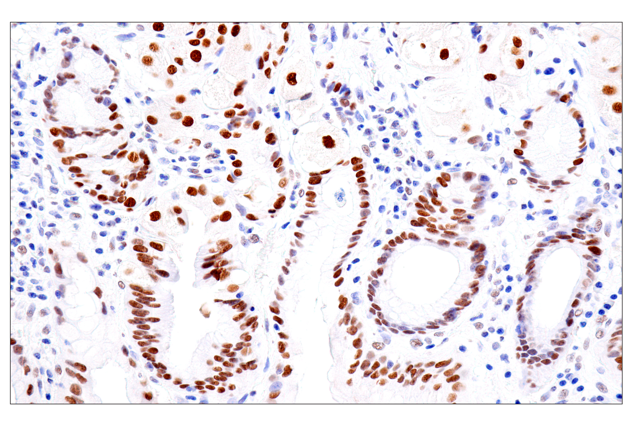 Immunohistochemistry Image 16: FoxA1/HNF3α (IHC578) Mouse mAb