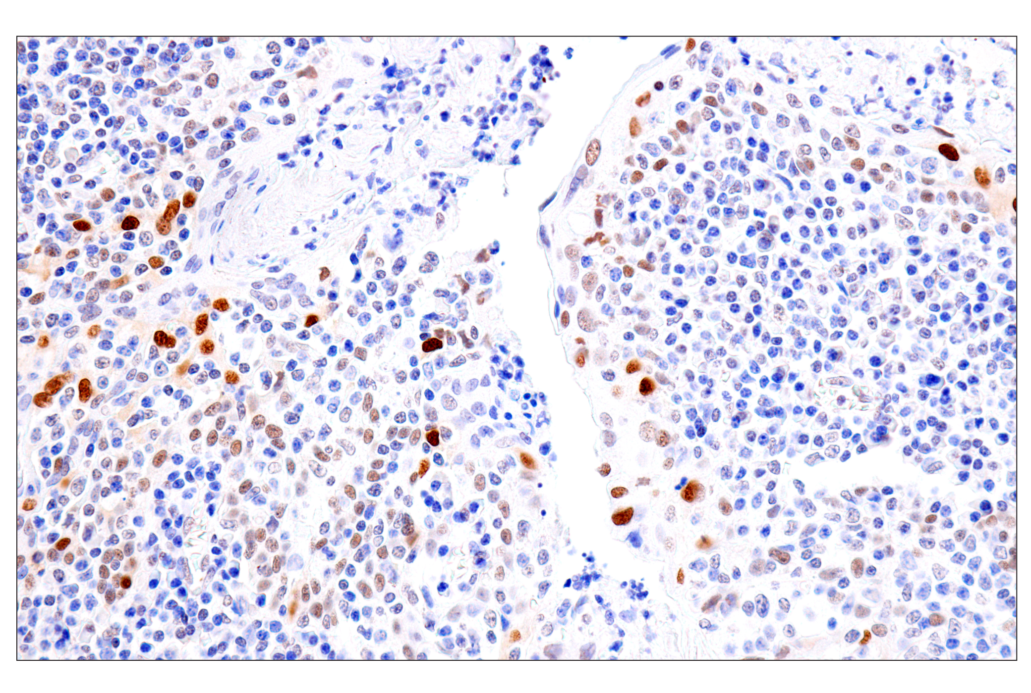 Immunohistochemistry Image 15: FoxA1/HNF3α (IHC578) Mouse mAb