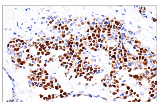 Immunohistochemistry Image 1: Myogenin (LO26) Mouse mAb