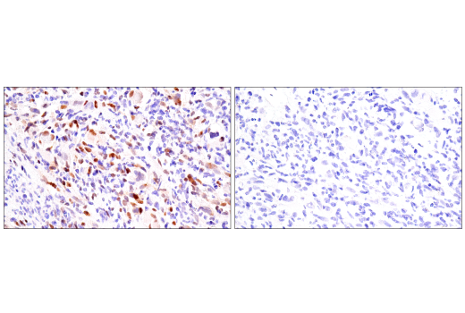 Immunohistochemistry Image 3: Myogenin (LO26) Mouse mAb