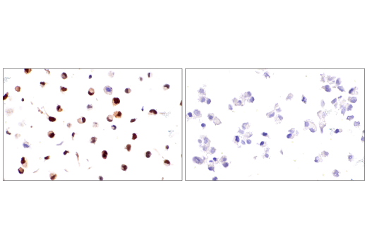 Immunohistochemistry Image 4: Myogenin (LO26) Mouse mAb
