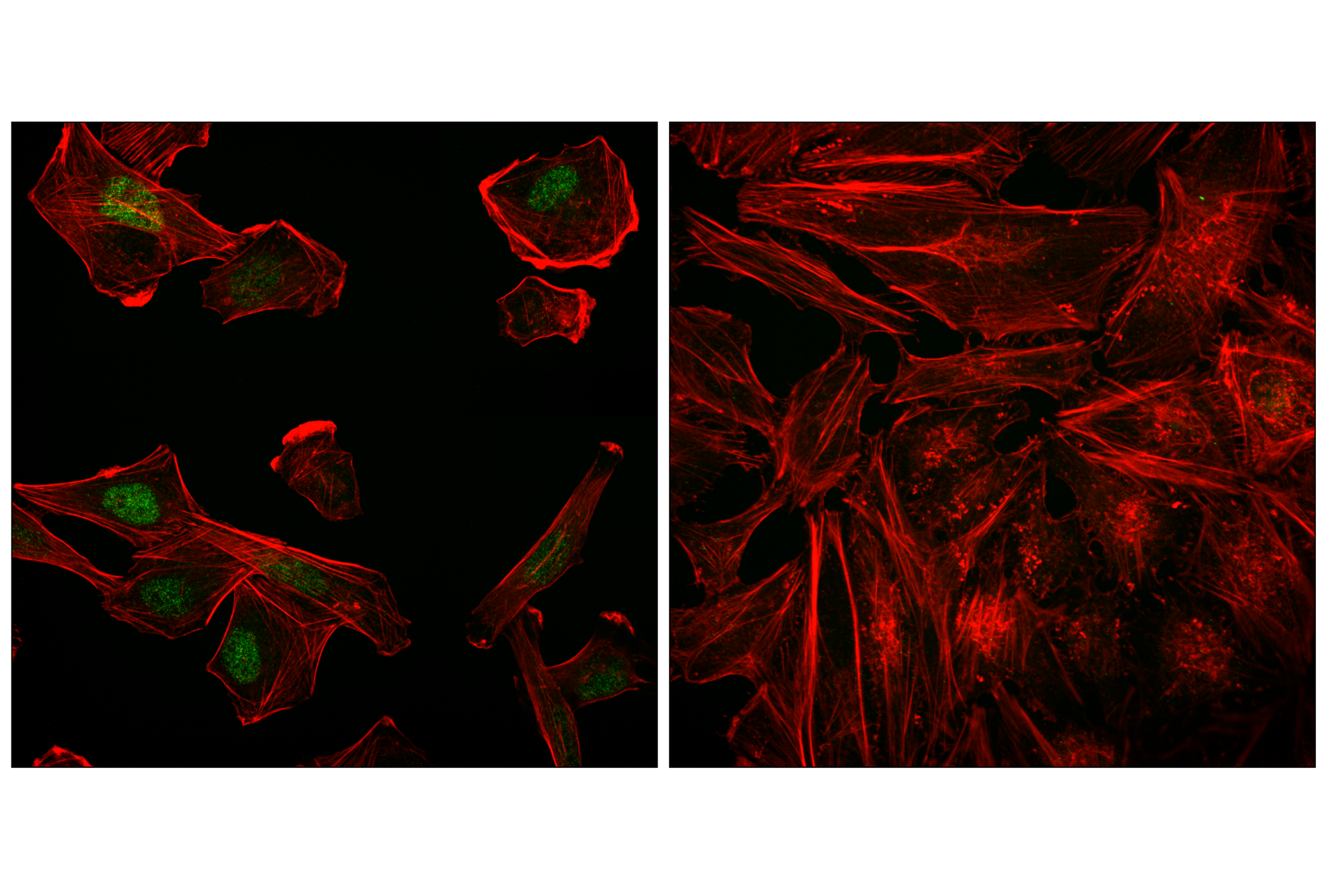 Immunofluorescence Image 1: Myogenin (LO26) Mouse mAb