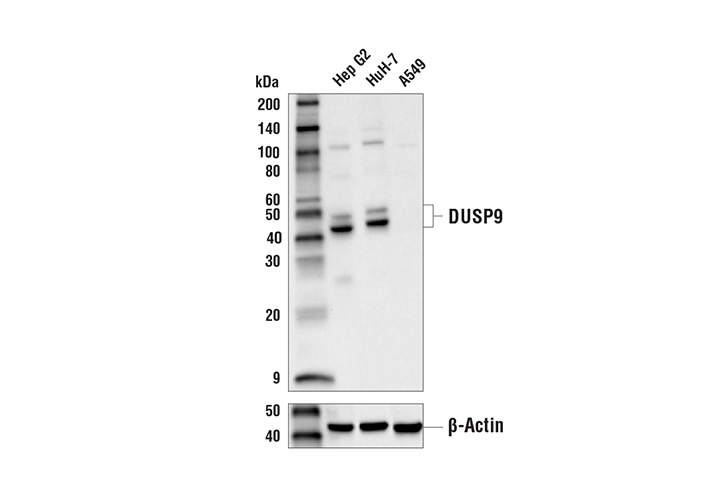 Western Blotting Image 1: DUSP9 Antibody