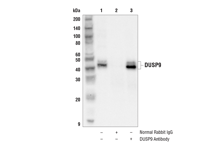 Immunoprecipitation Image 1: DUSP9 Antibody